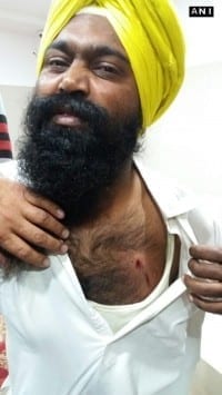 Gurpreet Singh showing the wound caused by the bullet
